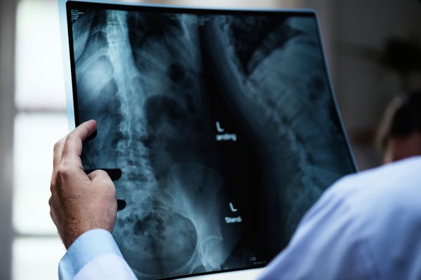 Rayos X en Salud Movil